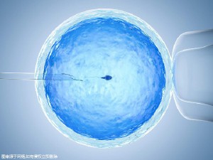 时差培养箱
